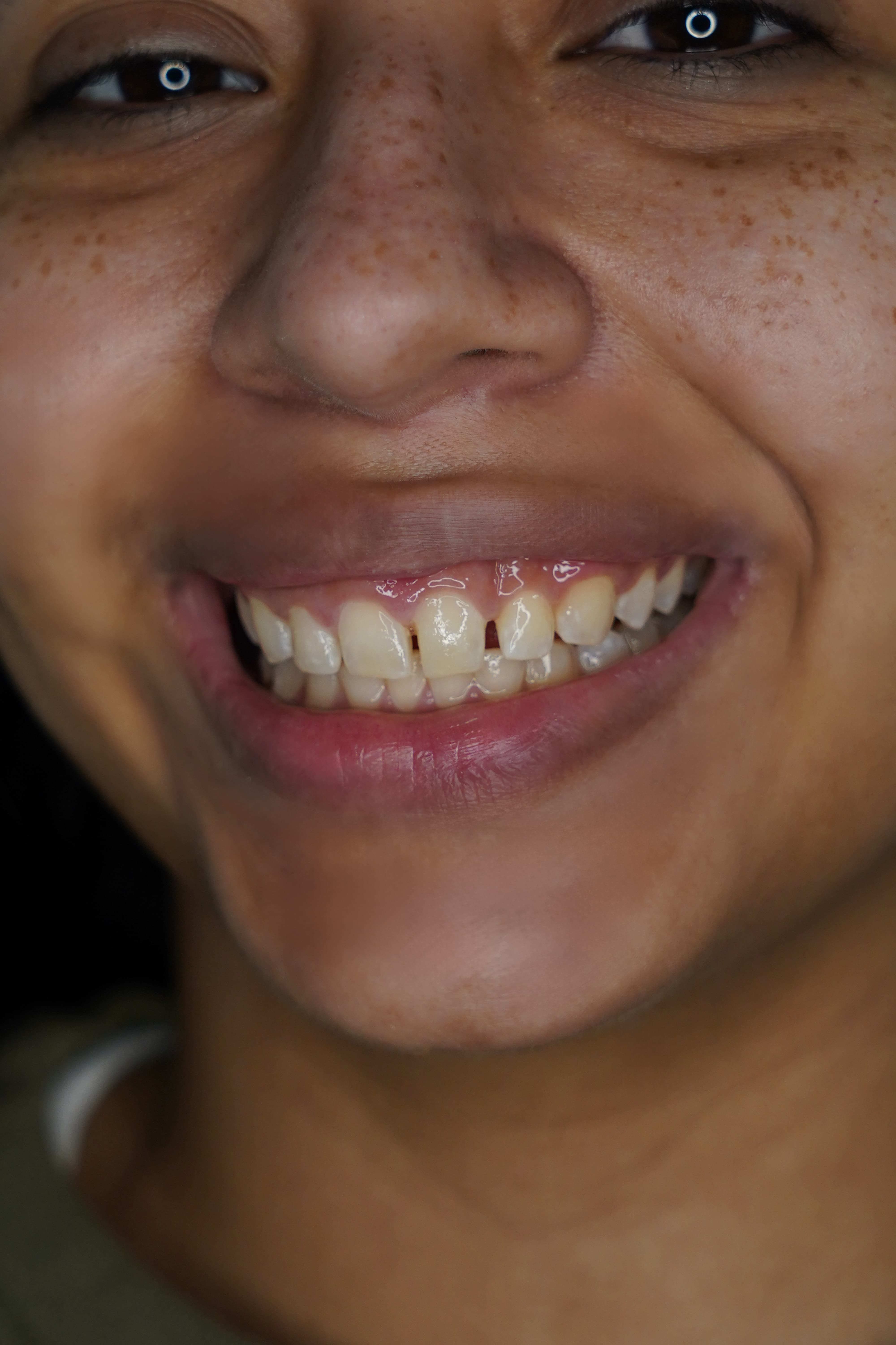 Caso 1 — antes
